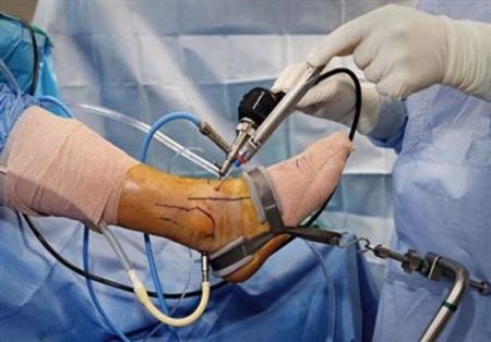 طراحی ارگونومیک دستگاه کشش دهنده پای بیمار حین عمل جراحی