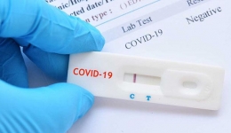 تشخیص COVID-19 از طریق آزمایش های موجود