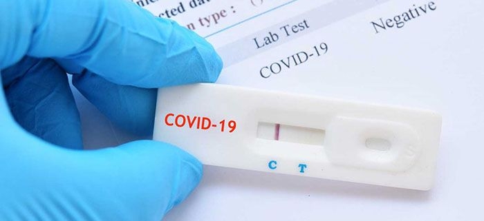تشخیص COVID-19 از طریق آزمایش های موجود