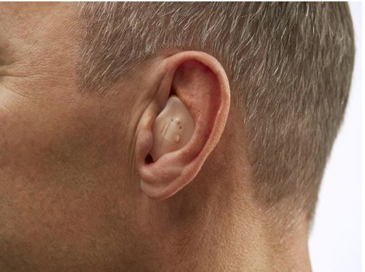 سمعک داخل گوش In the Ear – ITE