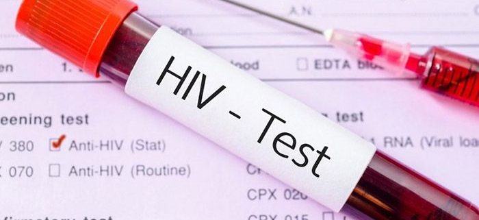 پرسشنامه بررسی کیفیت زندگی سازمان جهانی بهداشت برای بیماران مبتلا به HIV