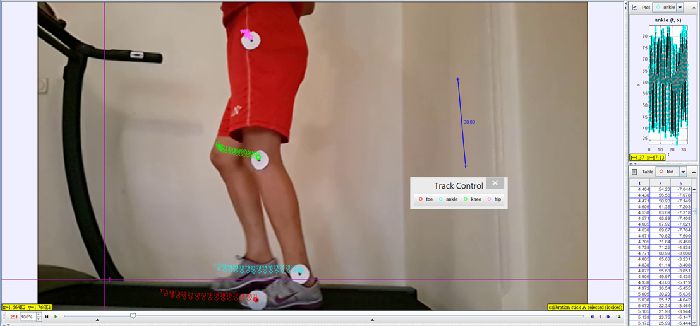 تحلیل پارامترهای سینماتیکی راه رفتن در بیمار آسیب دیده از ناحیه مچ پا با استفاده از نرم افزار tracker